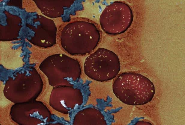 Cette image représente des globules rouges entourés de nanoparticules d'or (petits points jaunes) chargées d'ADN et qui s'activent au contact d'un rayonnement laser. © Helena de Puig