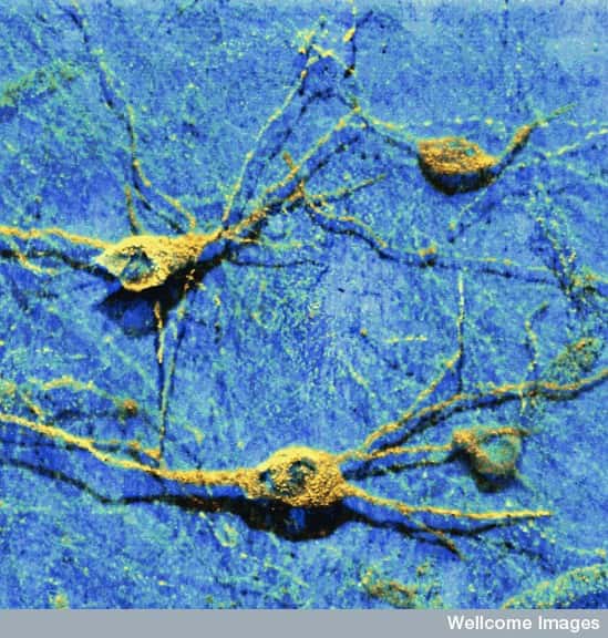 La suractivation de PDK1 favorise l'apparition des protéines néfastes pour la survie des neurones, comme les prions PrP<sup>Sc</sup> et les Aβ40/42. © <em>Med. Mic. Sciences Cardiff University</em>, Wellcome Images, cc by nc nd 2.0