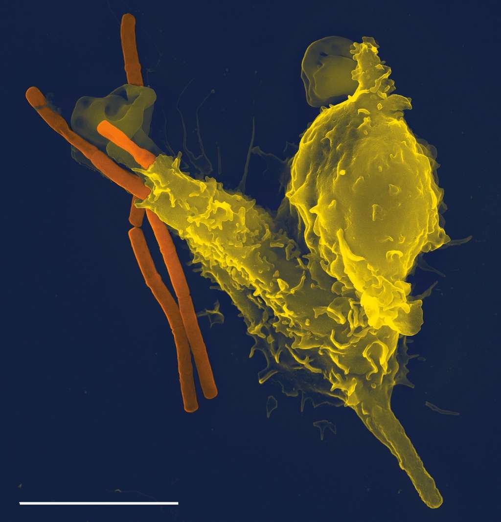 Les polynucléaires neutrophiles (en jaune) ont la capacité de digérer les agents étrangers (en orange). © Volker Brinkmann