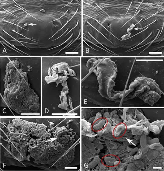 Photographies au microscope électronique à balayage sur des femelles d'<em>Oedothorax retusus</em> d'un petit bouchon génital mâle (A), de bouchons plus larges et plus ou moins homogènes (B), (C), (E), abîmé après 67 tentatives de copulation par un mâle secondaire (D), en présence de spermatozoïdes de 3 micromètres environ (cercles rouges) (F) et (G). © Katrin Kunz <em>et al.</em>