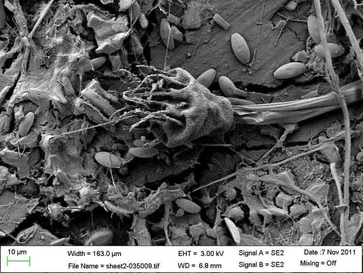 Une ciliée <em>Suctoria</em> couverte de bactéries symbiotiques et des diatomées, fixées sur un morceau de plastique fissuré et altéré. © Erik Zettler, <em>Sea Education Association</em>