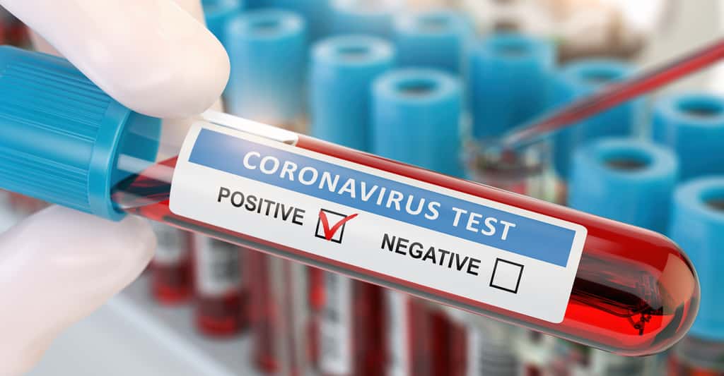 Selon les chercheurs, de nombreux porteurs du coronavirus sont asymptomatiques. Ils peuvent tout de même transmettre la maladie par des gouttelettes qu’ils expulsent en parlant ou simplement en respirant. © Maksym Yemalyanov, Adobe Stock