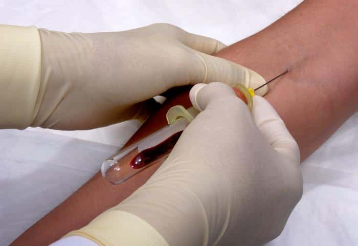 Une prise de sang est nécessaire pour détecter l'état sérologique du patient. Si dans son sang circulent les anticorps recherchés, alors le patient est séropositif. Dans le cas contraire, on le dit séronégatif. © James Gathany, CDC