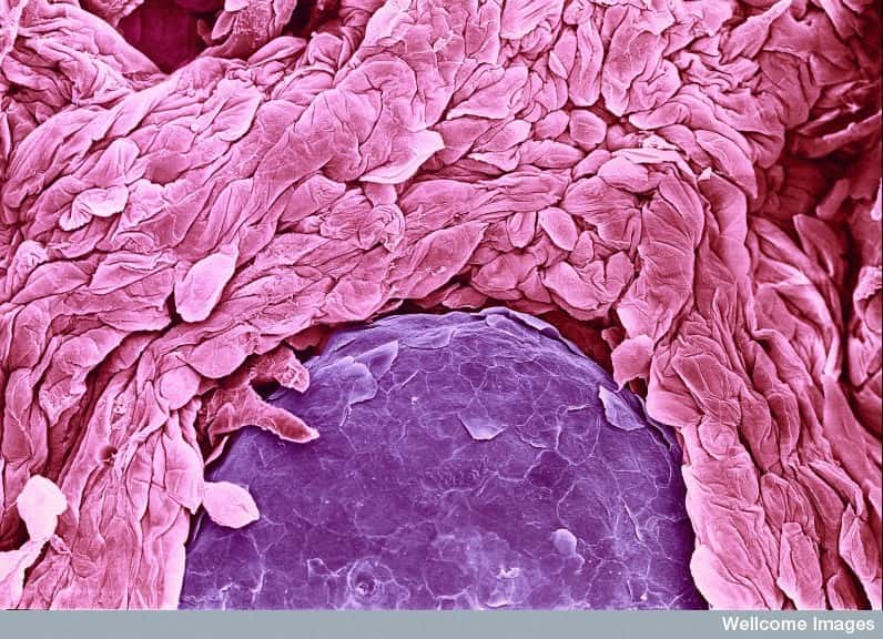 Le psoriasis touche la peau, mais aussi d'autres tissus auxquels on pense moins, comme la langue, représentée sur cette image prise en microscopie électronique à balayage. © David Gregory, Debbie Marshall, Wellcome Images, Flickr, cc by nc nd 2.0