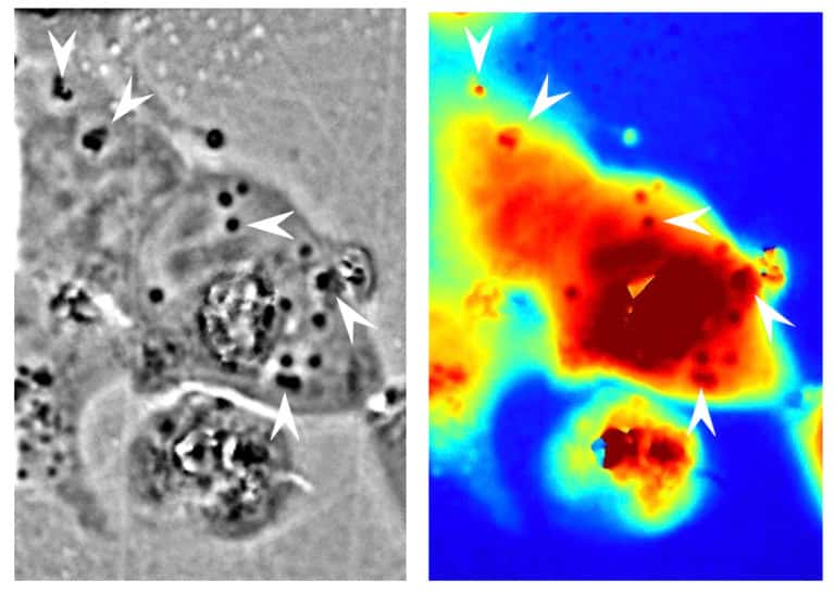 L’image en noir et blanc du microscope à contraste de phase montre – indiquées par des flèches blanches – les nanostructures de réflectine de calmar présentes dans les cellules humaines développées par les chercheurs de l’université de Californie à Irvine (États-Unis). L’image en couleur montre la différence de longueur du trajet de la lumière lorsqu’elle passe par une zone donnée. Le rouge correspond à un trajet long, le bleu à un trajet plus court. © Atouli Chattejee, Université de Californie