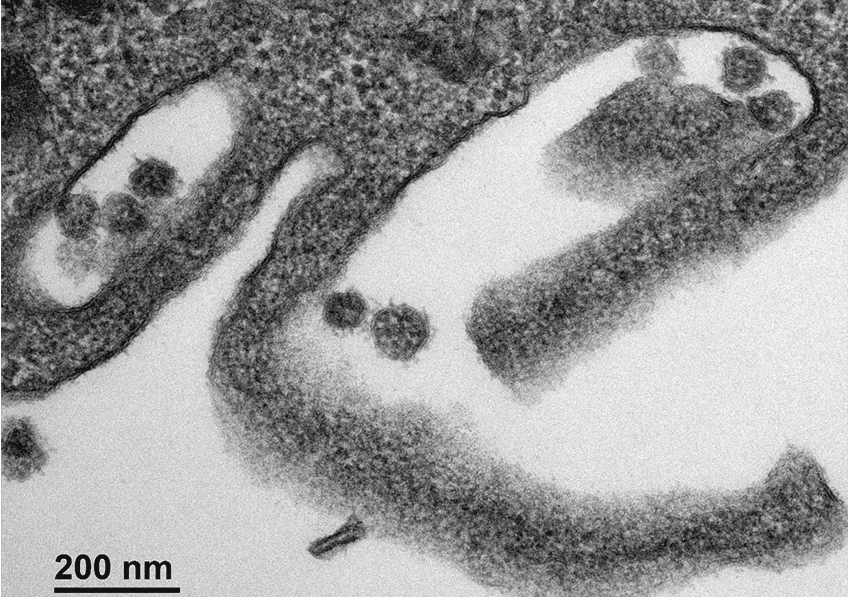 Cellule infectée par le SARS-CoV-2. © Sébastien Eymieux et Philippe Roingeard, Inserm, Université de Tours 