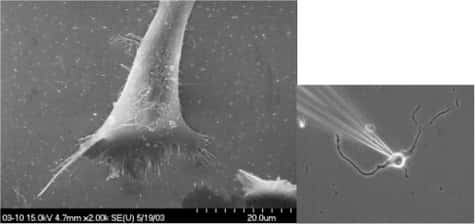 A gauche, des neurones en culture, observés au microscope électronique. A droite, le montage d'une électrode pour recueillir le signal nerveux émis par un neurone. Crédit : Todd Pappas / UMTB