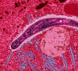 Plasmodium Falciparum, le parasite provoquant le paludisme chez l'Homme. Crédit Université J. Hopkins.