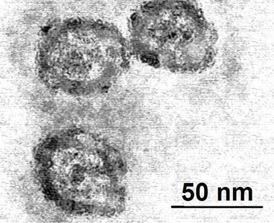 Le virus de l'hépatite C vu au microscope électronique. © PhD Dre / Licence <em>Creative Commons</em>