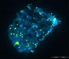 Image prise au microscope à épifluorescence du noyau (bleu) d'une cellule traitée au Q-FISH. Chaque point vert représente un télomère (la barre d'échelle représente 4 micromètres). © <em>Molecular Human Reproduction</em>