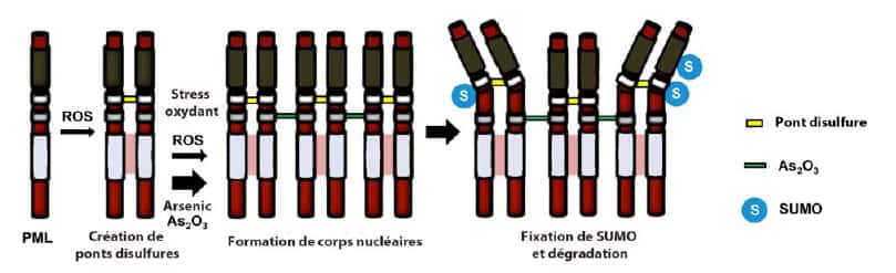 Modèle d'action de l'arsenic sur l'agrégation et la destruction des oncogènes PML/RARA dans le traitement de la leucémie aiguë promyélocytaire. Les ROS favorisent l'agrégation des PML/RARA, encore renforcée par la fixation de l'arsenic. Les corps nucléaires ainsi formés subissent des <em>sumoylations</em> (accrochage de protéines Sumo, <em>Small Ubiquitin-like Modifier</em>), puis une dégradation ciblée. © Inserm / CNRS / <em>Cancer Cell</em>