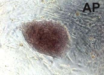 Une colonie de cellules souches pluripotentes induites obtenues à partir de cellules sanguines. AP : coloration à la phosphatase alcaline, marqueur des cellules souches. © <em>Cell Stem Cell</em>