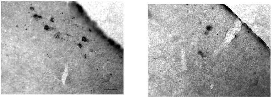 Les plaques amyloïdes, taches sombres révélées par un anticorps spécifique du peptide A&#946;, sont plus nombreuses chez les souris modèles de la maladie exprimant la protéine SIRT1 à un taux normal (à gauche), que chez les souris surexprimant SIRT1 (à droite). © MIT / <em>Cell</em>