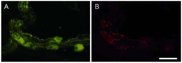 Immunomarquage du système nerveux entérique sur une biopsie du côlon. A : marquage des neurones (en vert). B : identification (en rouge) des inclusions pathologiques (neurites de Lewy). Échelle 30 µM. © Inserm