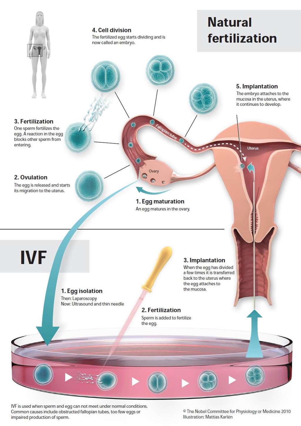 La voie de fécondation naturelle (partie du haut) comprend la maturation de l'ovocyte dans l'ovaire (1), l'ovulation (2), la fécondation par les spermatozoïdes dans la trompe de Fallope (3), la division cellulaire (4) et l'implantation de l'embryon dans l'utérus. La fécondation <em>in vitro</em> (partie du bas) consiste en la récupération de l'ovocyte maturé (1), la fécondation par les spermatozoïdes et finalement la réimplantation dans l'utérus de l'embryon (3) qui a commencé à se diviser. © <em>The Nobel Committee for Physiology or Medicine 2010</em> / Illustration : Mattias Karlén