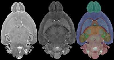 Comparaison des images d'une même coupe de cerveau. La première (gauche) a été obtenue par observation optique alors que celle du milieu a été obtenue par résonance magnétique. La dernière (droite) est une coloration des différentes structures cérébrales identifiées grâce à la précision de l'imagerie par résonance magnétique. © G. Allan Johnson, <em>Duke Center for In Vivo Microscopy</em>