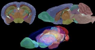 Les images du cerveau de souris, obtenues par résonance magnétique, sont isotropiques, c'est-à-dire que la résolution est aussi bonne quel que soit l'angle de vue adopté. Des coupes dans le plan frontal (en haut à gauche) ou dans le plan sagittal (en haut à droite) sont aussi informatives l'une que l'autre. © G. Allan Johnson, <em>Duke Center for In Vivo Microscopy</em>