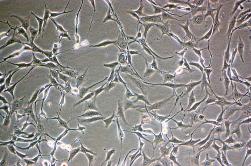 Des fibroblastes peuvent être reprogrammés en cellules sanguines grâce à l'expression du gène <em>oct4 </em>et à la mise en culture des cellules dans un milieu contenant des cytokines particulières. © Raffyd, Flickr, CC by-nc 2.0