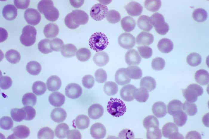 Le parasite <em>Plasmodium </em>est observable dans le sang des patients, parmi les globules rouges. © DR