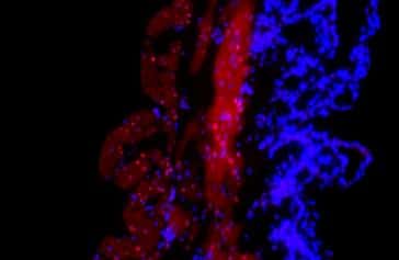 La protéine ZEB1 (en rouge) est présente dans le myomètre de l'utérus de souris pendant la gestation. Les noyaux des cellules sont colorés en bleu. © Carole Mendelson, <em>Pnas</em>
