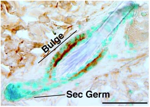 Chez un follicule de souris, la protéine CD34 est exprimée dans le renflement (<em>bulge</em>), mais pas dans les cellules progénitrices (<em>sec germ</em>), d'après l'immunomarquage (en marron). © <em>Journal of Clinical Investigation</em>