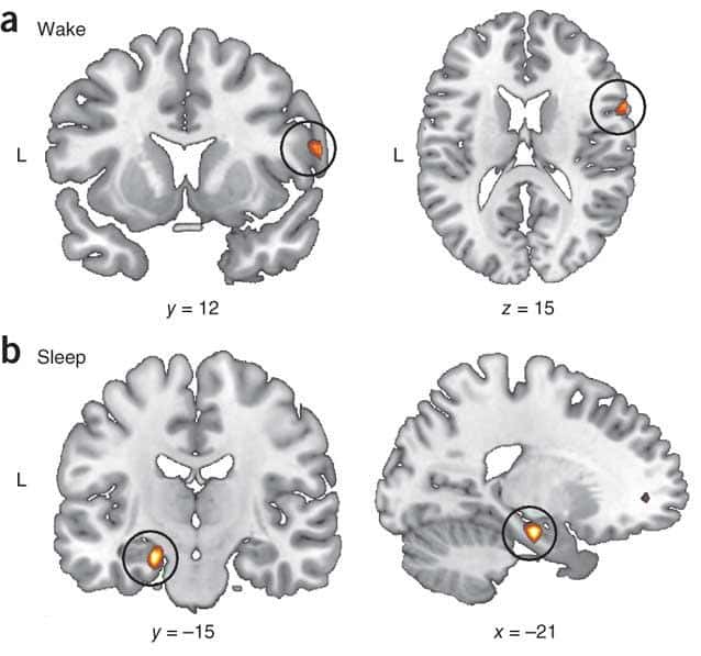 Les zones du cerveau activées pendant la réactivation du souvenir ne sont pas les mêmes en éveil ou pendant le sommeil. Le cortex préfrontal droit est activé en éveil (a), alors que c'est l'hippocampe gauche qui est préférentiellement activé pendant le sommeil (b). © <em>Nature Neuroscience</em>