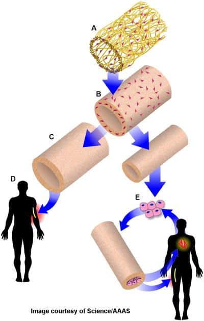 Les artères biosynthétiques sont fabriquées sur un polymère (A), à l'aide de cellules musculaires (B), qui sont ensuite éliminées (C). Elles peuvent alors être utilisées comme accès vasculaire pour les patients sous dialyse (D), ou pour des pontages coronariens (E). © <em>Image courtesy of Science/AAAS</em>