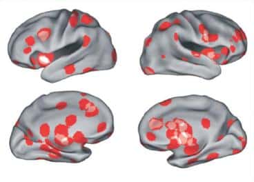 L'analyse combinée de l'étude de l'amour par IRM fonctionnelle sur 120 personnes montre 12 zones cérébrales préférentiellement activées. © Ortigue, <em>The journal of sexual medicine</em>