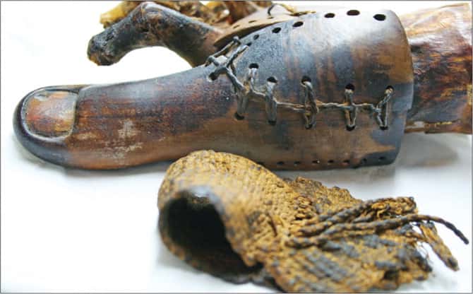 La prothèse en bois et en cuir permet une sorte d'articulation à l'avant du pied. © Jacqueline Finch, <em>The Lancet</em>