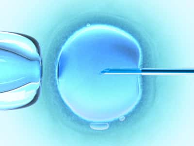 L'injection intracytoplasmique de sperme dans l'ovule est une des techniques de procréation médicalement assistée couramment utilisée. © Crédits duofertility.com