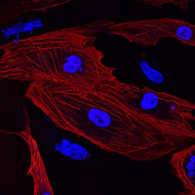 Les nouveaux cardiomyocytes (dont la troponine est colorée en rouge, et le noyau en bleu) issus du processus de régénération proviennent de la multiplication des cardiomyocytes, et non pas de cellules progénitrices. © Arboreus, Flickr, CC by-nc 2.0