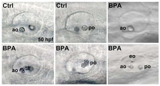 Les otolithes antérieurs et postérieurs des embryons traités au bisphénol A (BPA) comparés aux embryons contrôles (Ctrl) présentent des anomalies : un seul otolithe (en haut à droite), ou un otolithe surnuméraire (en bas à droite) ou des agrégations (en bas, centre et gauche). © <em>BMC Developmental Biology</em>