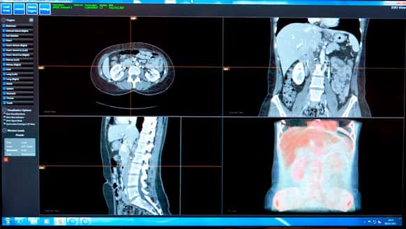 Le logiciel InnerEye visualise ici différentes vues réalisées à partir d'un examen par un tomographe, ou CT-scan (Computed Tomography). © Microsoft Research