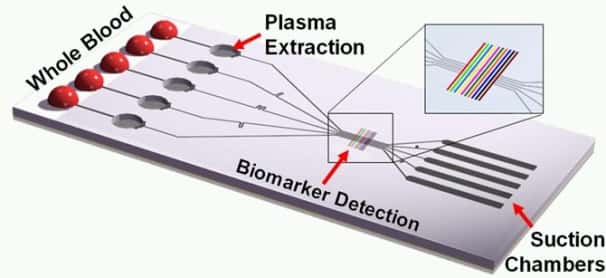 Le sang à analyser s’écoule de gauche à droite en quelques minutes, grâce à une dépression créée à droite (<em>Suction Chambers</em>). Les globules rouges et blancs, plus lourds, sont arrêtés dans les cuvettes (<em>Plasma Extraction</em>) et le plasma s’écoule jusqu’au dispositif de détection de biomarqueurs. © Ivan Dimov/UC Berkeley