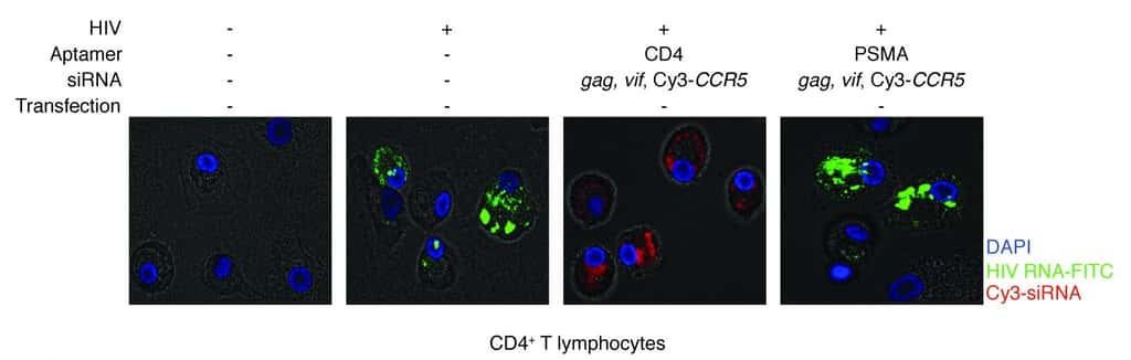 Les lymphocytes T (cellules aux noyaux colorés en bleu au DAPI) contiennent le VIH (dont l'ARN est visualisé en vert), sauf si elles n'ont pas subi d'infection (à gauche) ou si elles ont reçu l'ARN chimérique (deuxième image en partant de la droite). © <em>Journal of Clinical Investigation</em>