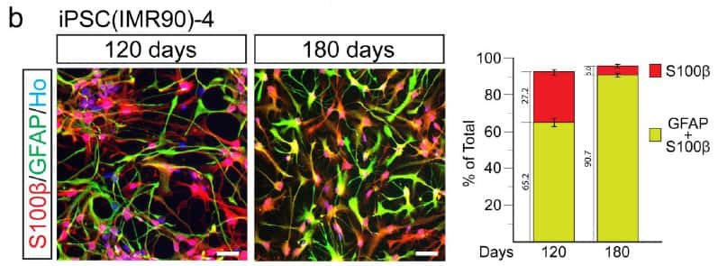Après 120 et 180 jours de culture, les cellules souches se transforment progressivement en astrocytes, ce qui est observé car elles expriment de plus en plus les protéines S100&#946; et GFAP (en rouge et en vert, et leur mélange, orange et jaune). © <em>Nature Biotechnology</em>  