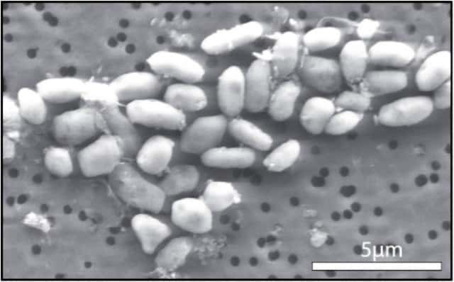 La bactérie GFAJ-1 cultivée avec de l'arsenic mais pas de phosphore. © Jodi Switzer Blum