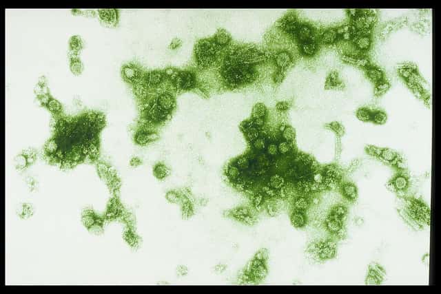 Le virus de la dengue, un des virus ciblés par le traitement Draco. ©  Sanofi Pasteur, Flickr, cc by nc nd 2.0