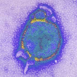 Le virus Hendra, observé au microscope électronique. © AJC1, CC by-nc 2.0