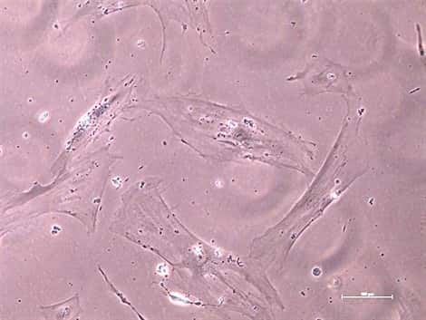 Des cellules de peau âgées, qui ne prolifèrent plus (échelle 100 µm). © Inserm