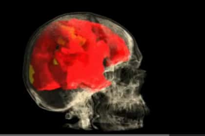 L'IRM fonctionnelle permet de lire des images du cerveau, pas de traduire des pensées. © Barry R. Komisaruk <em>et al</em>./YouTube