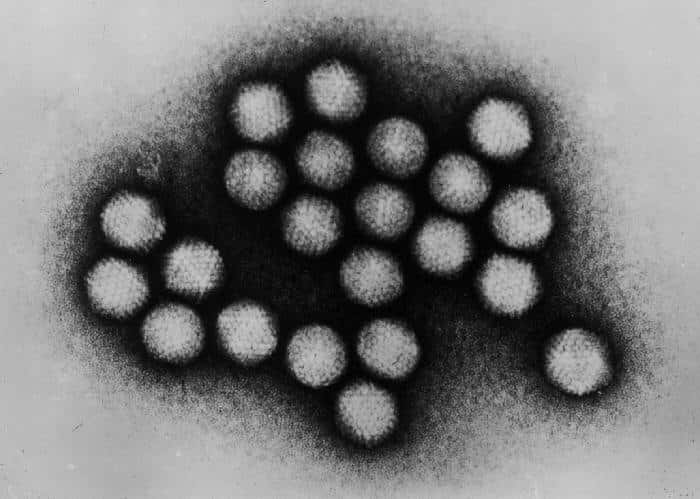 Les adénovirus, ici observés au microscope électronique à transmission, sont des virus à ADN qui peuvent être utilisés comme vecteurs de transfert de gènes. Ici, c'est le virus adénoassocié AAV8, infectant les cellules hépatiques sans dommage, qui a été utilisé. © <em>Center for Disease Control and Prevention</em>, Wikipédia, DP