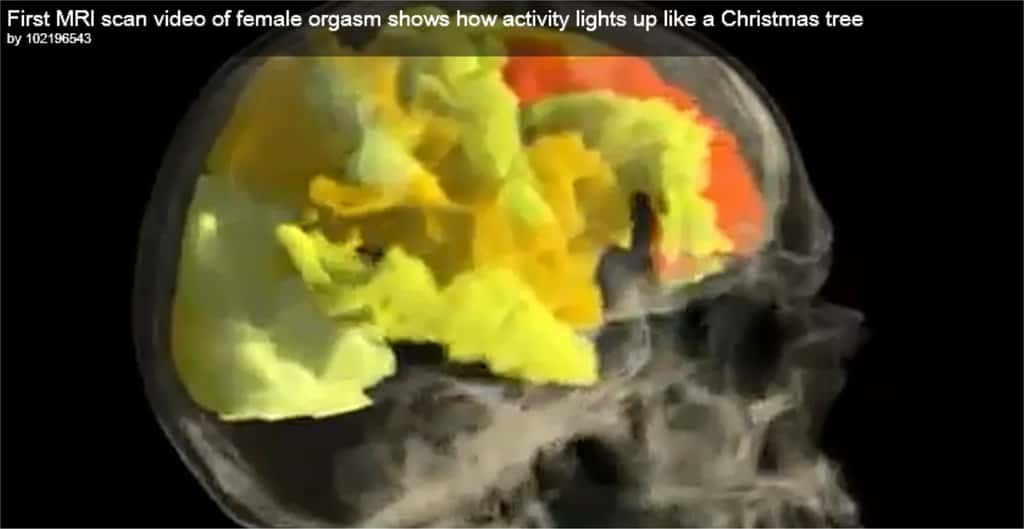 Pendant l'orgasme d'une femme, le cerveau s'illumine si on le regarde par IRM. Les zones les plus claires correspondent aux zones les plus actives tandis que les plus rouges sont les moins irriguées par le sang. © Barry R. Komisarul <em>et al.</em> / Youtube