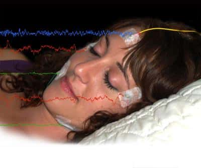 La polysomnographie permet de visualiser plusieurs paramètres physiologiques durant le sommeil, comme le rythme cardiaque, la fréquence respiratoire, l'activité cérébrale, la motricité... Grâce à cet outil, les chercheurs ont pu montrer que la durée de la période <em>REM</em> (<em>Rapid eye movement</em>) durant le sommeil paradoxal renforçait les émotions négatives liées à un événement traumatique. © <em>University of Massachusetts Amherst</em>