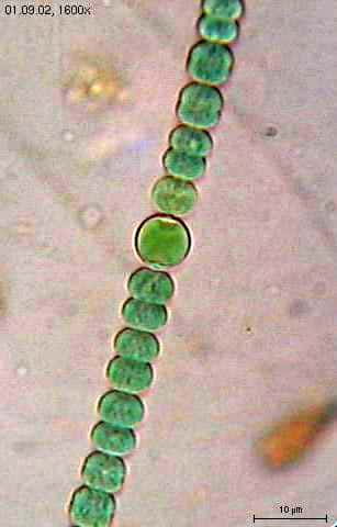 Les cyanobactéries, comme ces <em>Anabaena sphaerica</em>, comptent parmi les êtres vivants les plus anciens de notre planète. Des traces révèlent leur présence il y a 3,5 milliards d'années au moins. © Elapied, Wikipédia, cc by sa 3.0