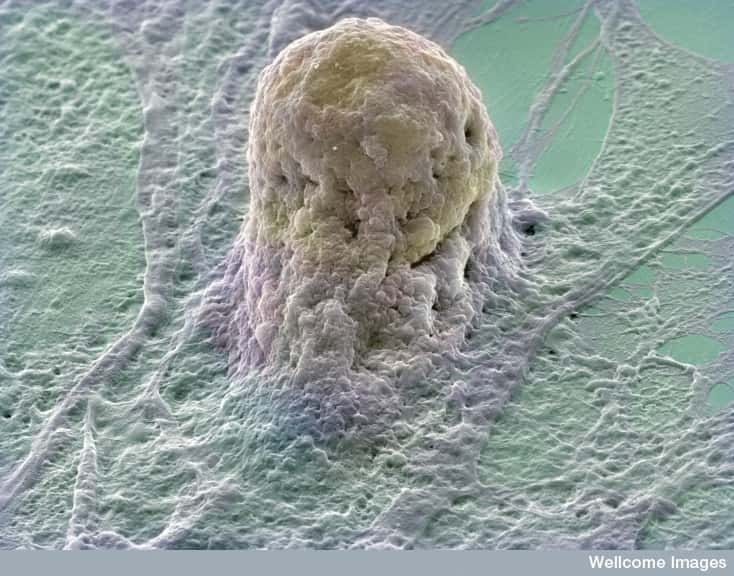 Les cellules souches pluripotentes ont la propriété de pouvoir se différencier en n'importe quel tissu adulte. Elles représentent à n'en pas douter l'avenir de la médecine. © Annie Cavanagh, Wellcome Images, Flickr, cc by nc nd 2.0
