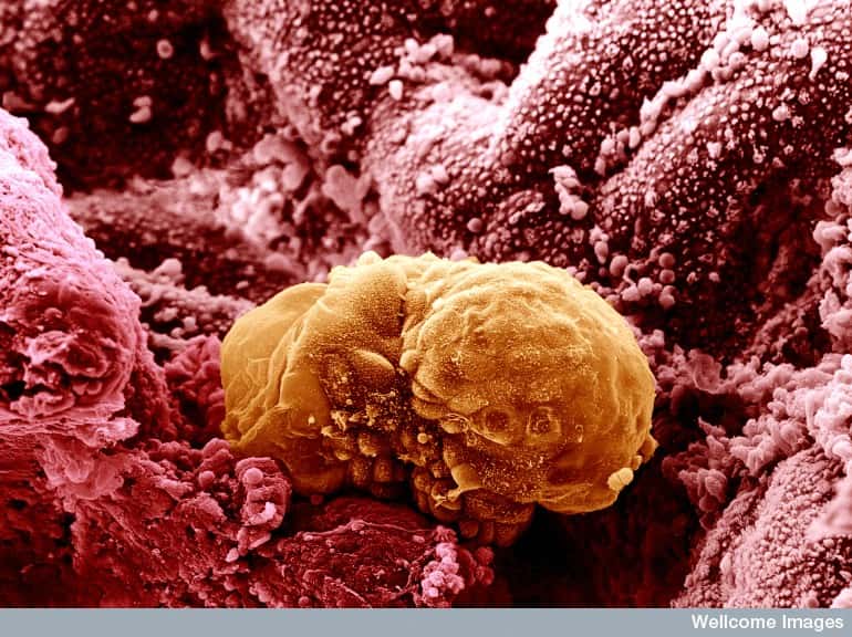 L'embryon humain à 6 jours, ici vu au microscope électronique à balayage, est encore minuscule et n'a pas encore forme humaine ou animale. Au stade blastocyste, c'est à cet âge qu'il est transplanté dans l'utérus de la mère. © Wellcome Images, Flickr, cc by nc nd 2.0