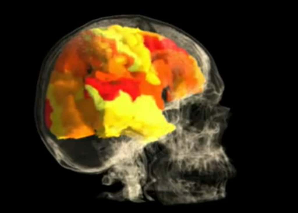 IRM montrant l'activation des zones du cerveau lors d'un orgasme. © Barry R. Komisaruk <em>et al.</em>/YouTube