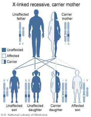 Les maladies génétiques récessives portées par le chromosome X, comme l'hémophilie, sont particulières. Ce schéma explique pourquoi. Les femmes étant dotées de deux chromosomes sexuels X, les risques de déclarer la maladie sont plus faibles, car il suffit d'une bonne version du gène pour être asymptomatique. Un homme en revanche peut recevoir un X malade de sa mère si elle est porteuse (<em>carrier</em>), et comme son père lui a fourni un chromosome Y, le gène du facteur de coagulation défaillant est seul à s'exprimer : il déclare la maladie (<em>affected</em>). © <em>National Institute of Health</em>, Wikipédia, DP