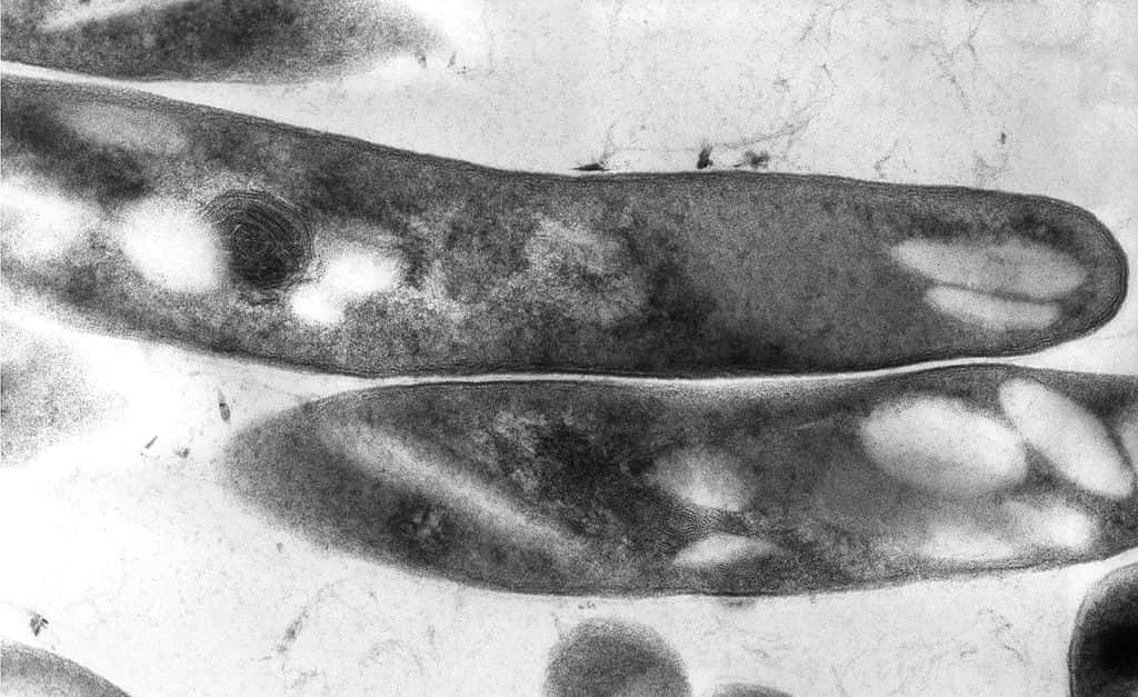 <em>Mycobacterium tuberculosis</em>, ici observé au microscope électronique à transmission, est également connu sous le nom de bacille de Koch. C'est une bactérie aérobie en forme de bâtonnet, longue de quelques micromètres, et capable de mettre à terre 1,4 million d'êtres humains chaque année. © Elizabeth Libby White, <em>Centers for Disease Control and Prevention</em>, Wikimédia Commons, DP